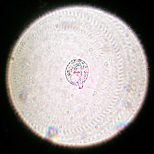 Goldalge, Dinoflagellat 21.07.2023-2.jpg