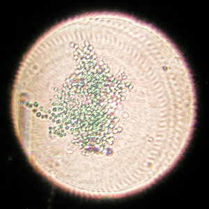 Cyanobakterien 01.12.2023-2.jpg