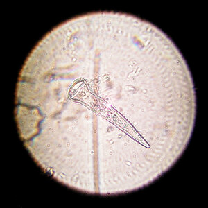 Stentor polymorphus 06.02.2023.jpg