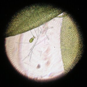 Oedogonium sp. Keimling 01.07.2025.jpg