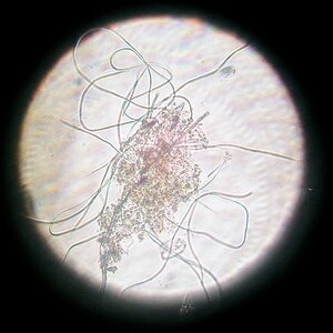Cyanobakterien-Oscillatoria 15.09.2025 .jpg