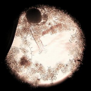 Dissotrocha macrostyla 11.10.2025.jpg