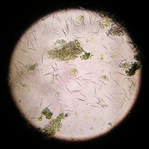 Microorganismen 12.01.2026.webp