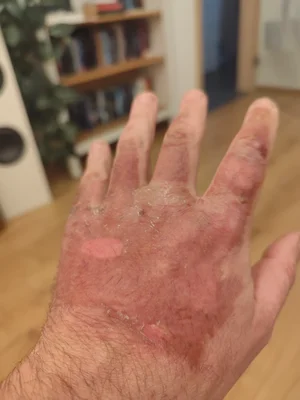 IMG_20260320_194133.webp IMG_20260320_194133.webp