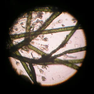 Glockentierchen-Vorticella 13.10.2020.webp