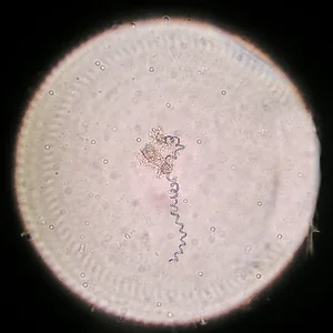 Glockentierchen-Vorticella 14.10.2022.webp