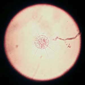 Sonnentierchen Actinophrys 28.06.2026.webp Sonnentierchen Actinophrys 28.06.2026.webp