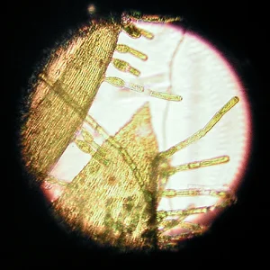 Oedogonium sp. Keimling mit Rhizoid- angedockt  09.08.2026.webp