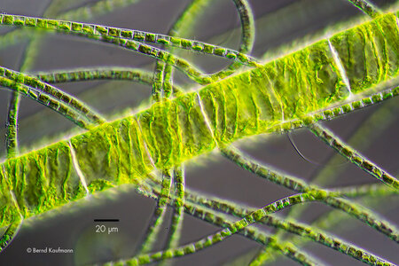Spirogyra_Ulothrix_DB.jpg